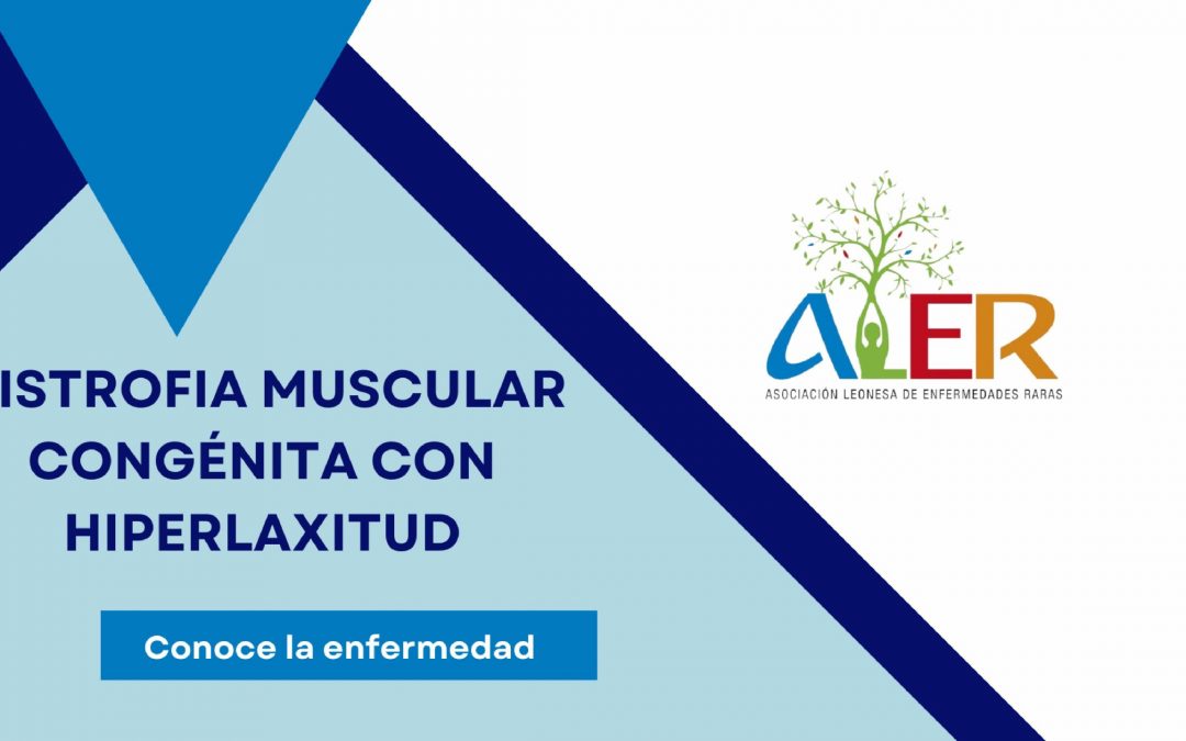 DISTROFIA MUSCULAR POR HIPERLAXITUD