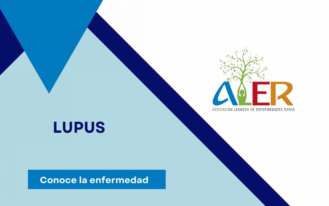 LUPUS ERITEMATOSO SISTÉMICO