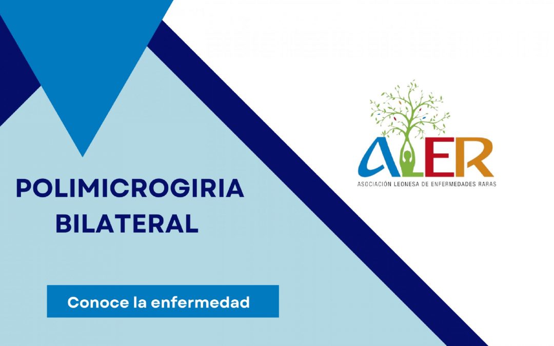 POLIMICROGIRIA BILATERAL, TRASTORNO